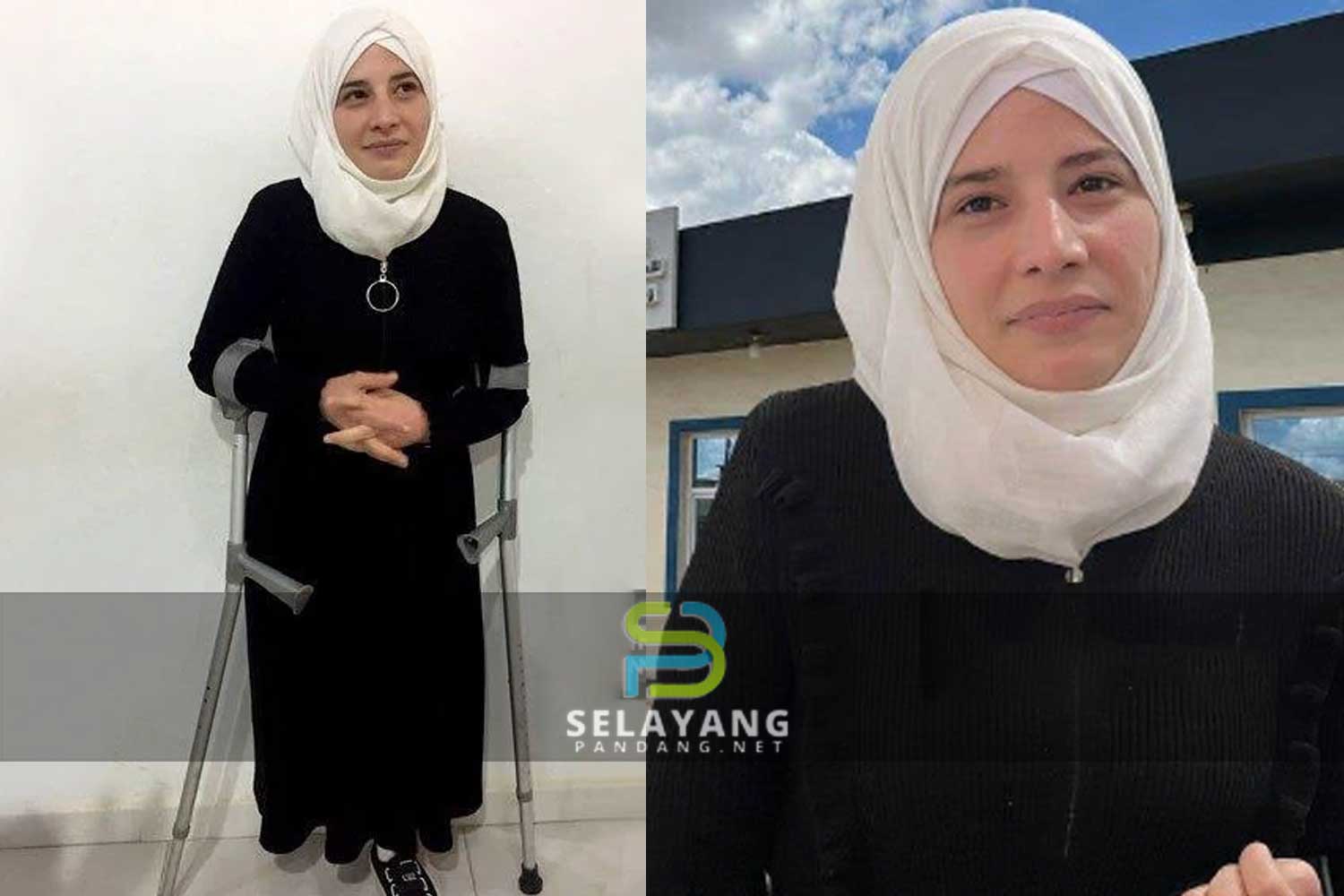 Suami bohong anak bagitahu ibu terkorban dalam serangan bom, rupanya dicerai sebab isteri cacat hilang kaki paras peha